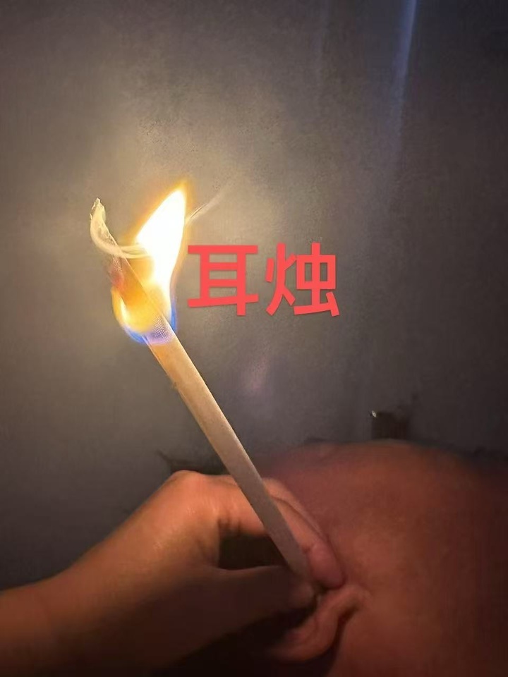 耳烛图.jpg